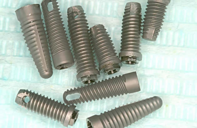 インプラントのの写真