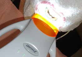 ホワイトニング中の写真